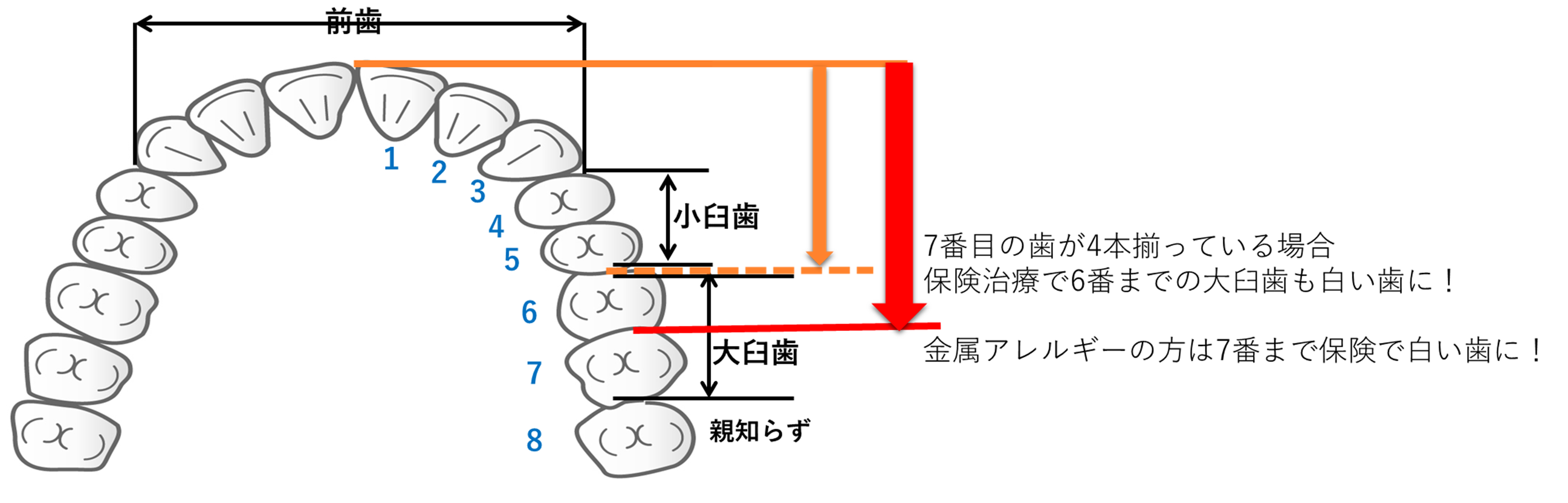 歯の保険